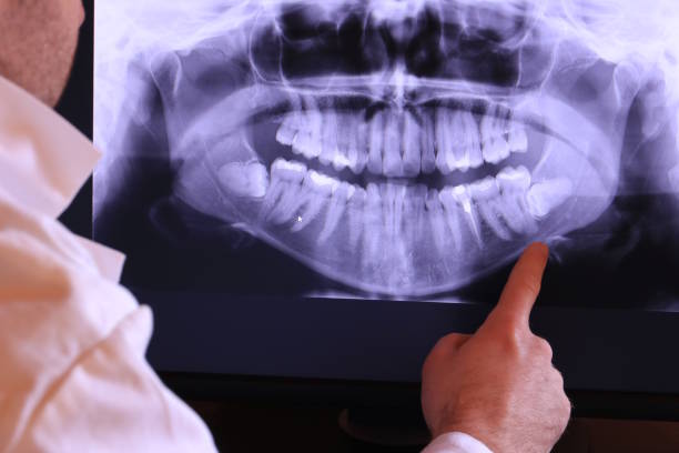 Best Pediatric Emergency Dentist in Rio Vista, TX